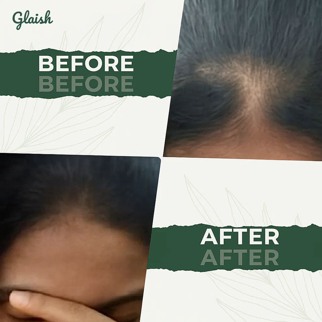 Glaish Hair Oil Homemade 7 Organic Oil + 24 Herbs