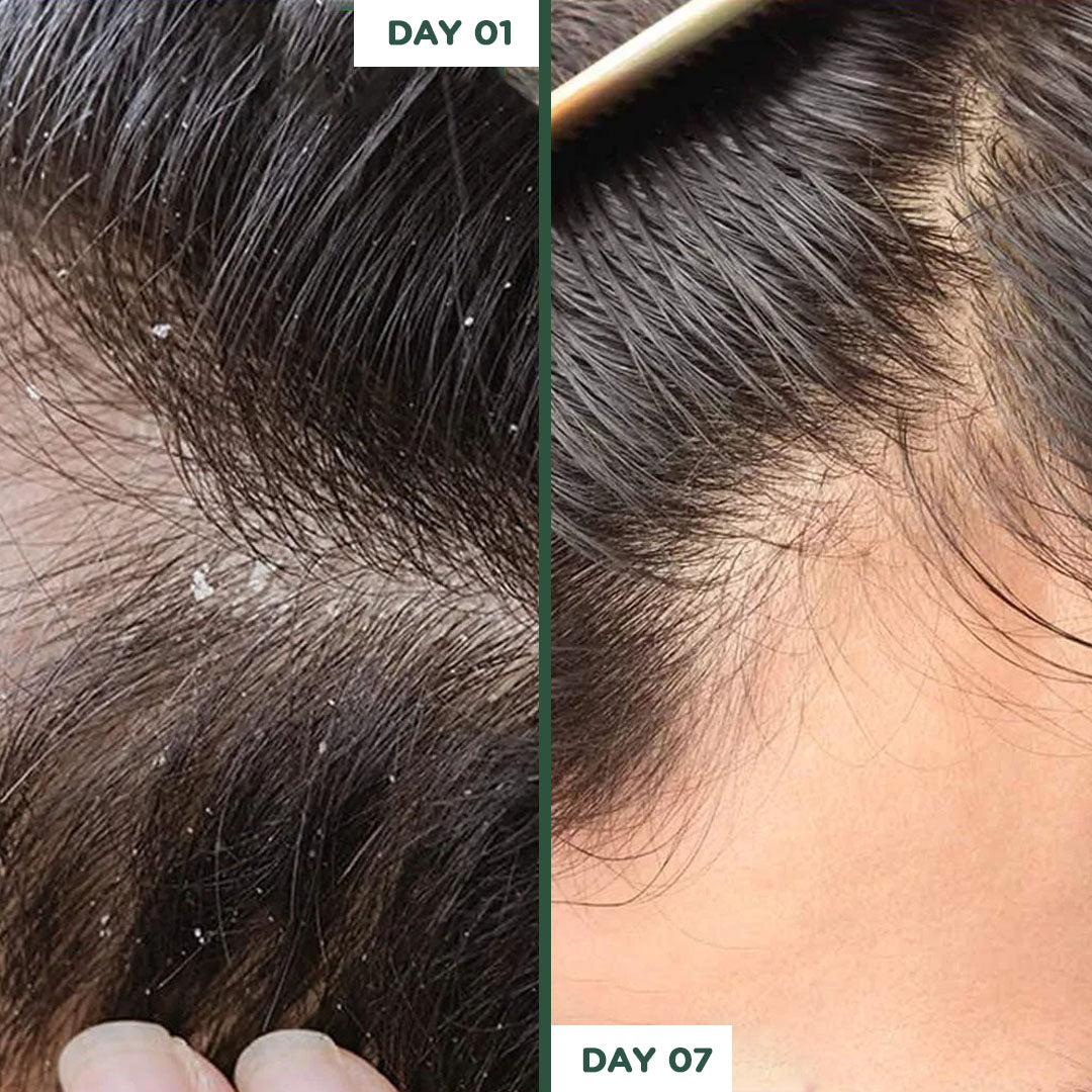 Glaish Homemade Crown Hair Care Kit - Glaish